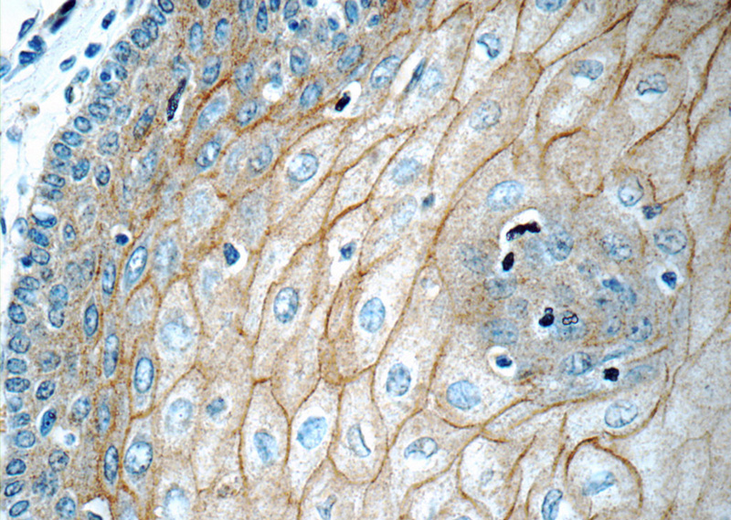 Immunohistochemistry of paraffin-embedded human oesophagus tissue slide using Catalog No:109898(DSC2 Antibody) at dilution of 1:50 (under 40x lens)