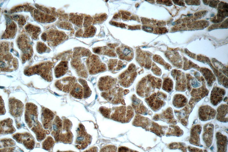 Immunohistochemistry of paraffin-embedded human heart tissue slide using Catalog No:111251(GUCY2F Antibody) at dilution of 1:50 (under 40x lens)