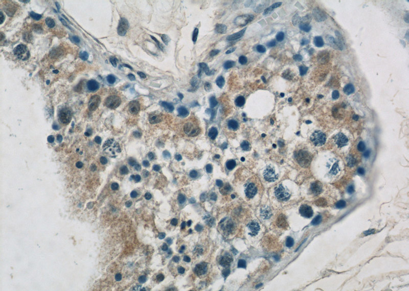 Immunohistochemistry of paraffin-embedded human testis tissue slide using Catalog No:111057(GPATCH2 Antibody) at dilution of 1:50 (under 40x lens)