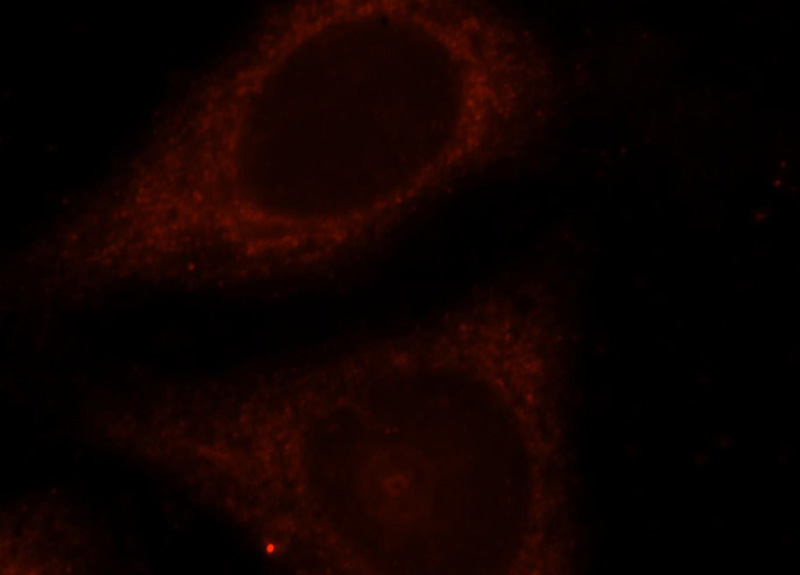 Immunofluorescent analysis of HepG2 cells, using HMMR antibody Catalog No:111490 at 1:25 dilution and Rhodamine-labeled goat anti-rabbit IgG (red).