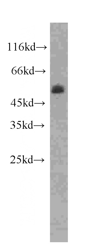 COLO 320 cells were subjected to SDS PAGE followed by western blot with Catalog No:107480(PPARD antibody) at dilution of 1:1000
