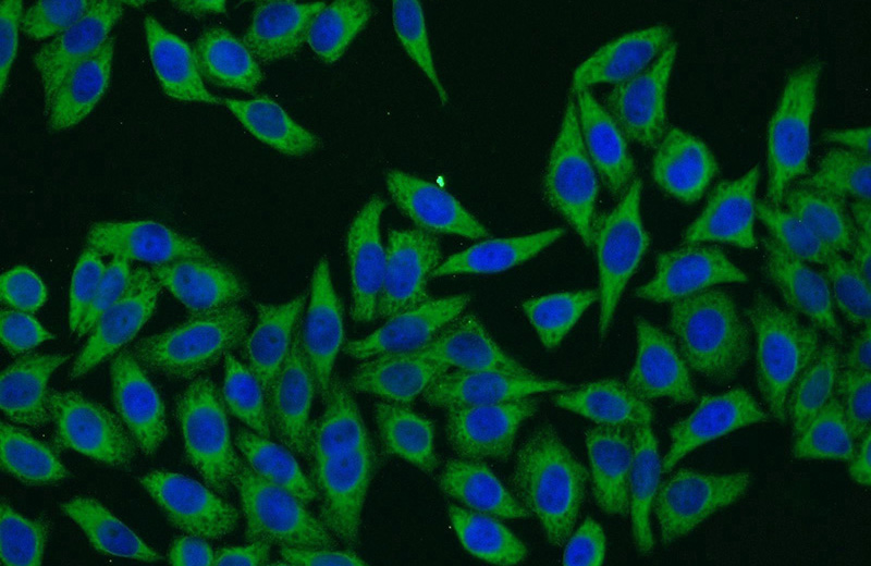 Immunofluorescent analysis of HeLa cells using Catalog No:111452(HPS3 Antibody) at dilution of 1:25 and Alexa Fluor 594-congugated AffiniPure Goat Anti-rabbit IgG(H+L)