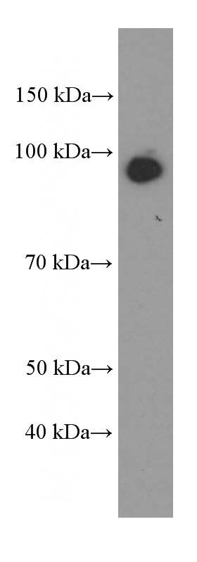 K-562 cells were subjected to SDS PAGE followed by western blot with Catalog No:107078(BBS2 Antibody) at dilution of 1:1000