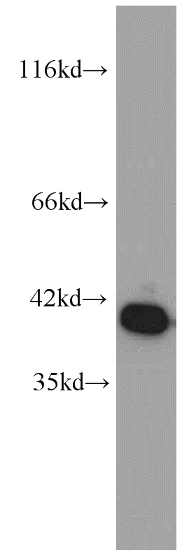 human brain tissue were subjected to SDS PAGE followed by western blot with Catalog No:107056(ANXA2 antibody) at dilution of 1:1000