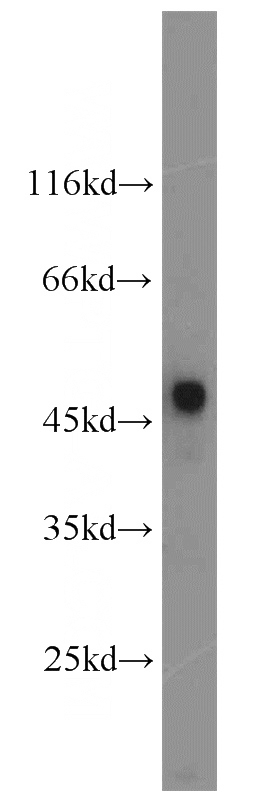 mouse eye tissue were subjected to SDS PAGE followed by western blot with Catalog No:114690(RENIN-RECEPTOR,ATP6AP2 antibody) at dilution of 1:600