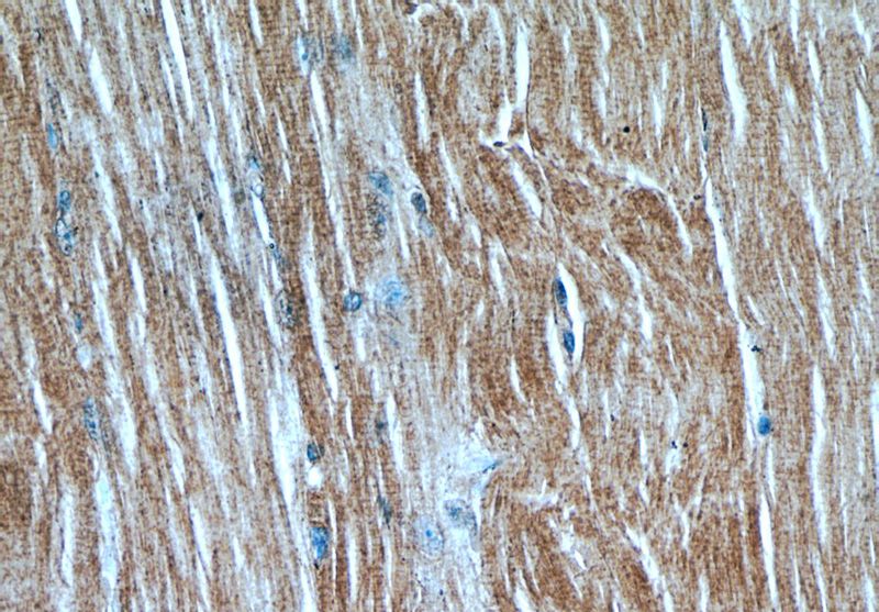 Immunohistochemical of paraffin-embedded human skeletal muscle using Catalog No:112426(MAP4K4 antibody) at dilution of 1:50 (under 40x lens)