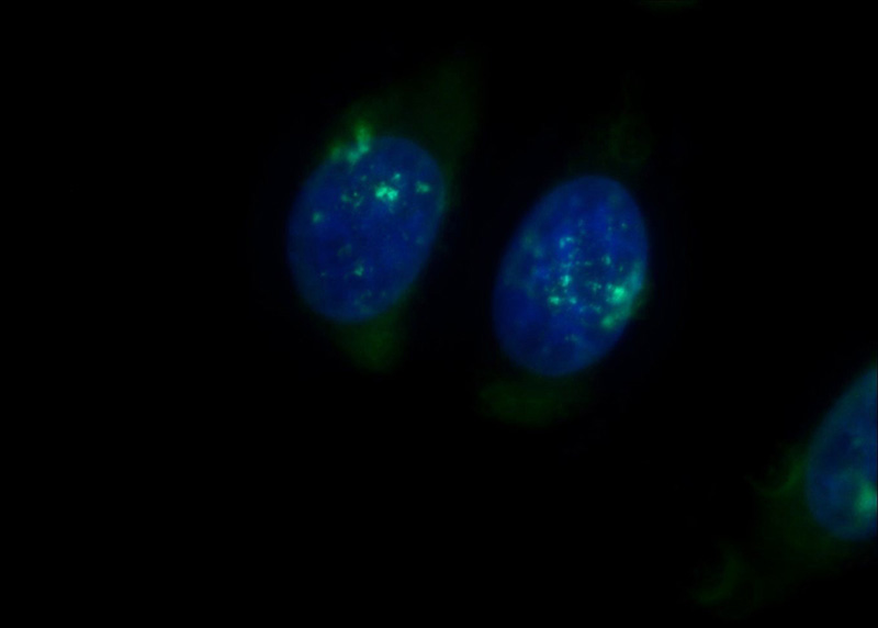 Immunofluorescent analysis of HepG2 cells using Catalog No:114383(PSMB3 Antibody) at dilution of 1:50 and Alexa Fluor 488-congugated AffiniPure Goat Anti-Rabbit IgG(H+L)