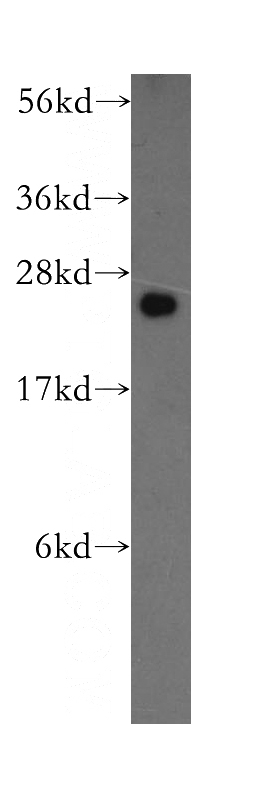 MCF7 cells were subjected to SDS PAGE followed by western blot with Catalog No:112837(MRPL9 antibody) at dilution of 1:500