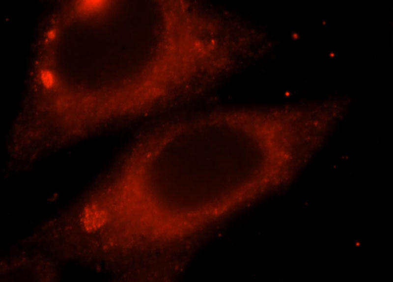 Immunofluorescent analysis of HepG2 cells, using MAPK10 antibody Catalog No:112430 at 1:25 diluiton and Rhodamine-labeled goat anti-rabbit IgG (red).