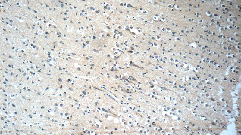Immunohistochemistry of paraffin-embedded human brain slide using Catalog No:111078(SLC2A3 Antibody) at dilution of 1:50