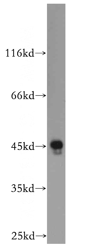Raji cells were subjected to SDS PAGE followed by western blot with Catalog No:110232(ELOVL6 antibody) at dilution of 1:800