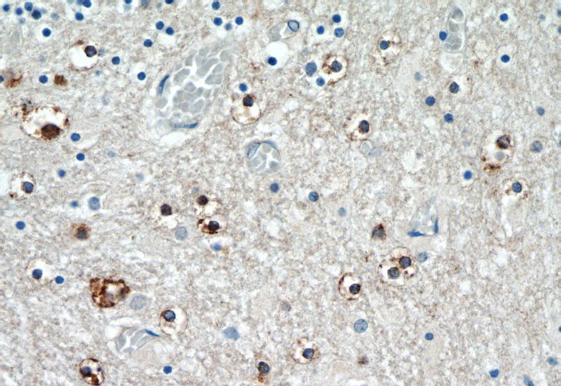 Immunohistochemistry of paraffin-embedded human cerebellum tissue slide using Catalog No:116158(TNRC4 Antibody) at dilution of 1:50 (under 40x lens)