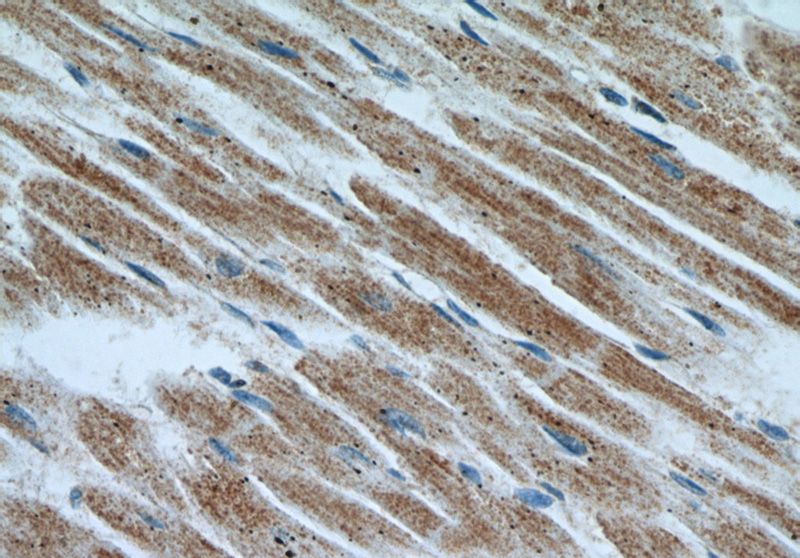 Immunohistochemical of paraffin-embedded human heart using Catalog No:111773(IL1RAPL1 antibody) at dilution of 1:50 (under 40x lens)