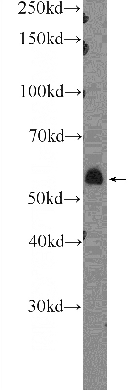 mouse skeletal muscle tissue were subjected to SDS PAGE followed by western blot with Catalog No:114139(PPM2C Antibody) at dilution of 1:300
