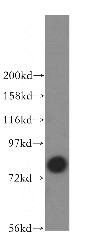 human liver tissue were subjected to SDS PAGE followed by western blot with Catalog No:115852(TARA antibody) at dilution of 1:500
