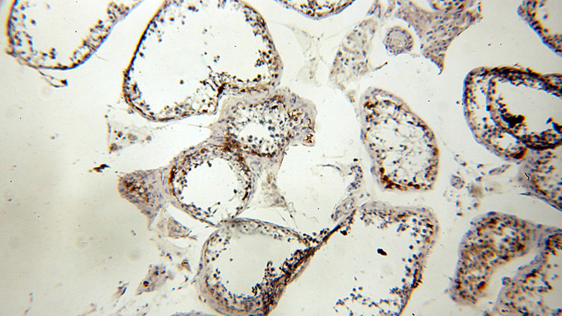 Immunohistochemical of paraffin-embedded human testis using Catalog No:112376(MAGEA1 antibody) at dilution of 1:100 (under 10x lens)