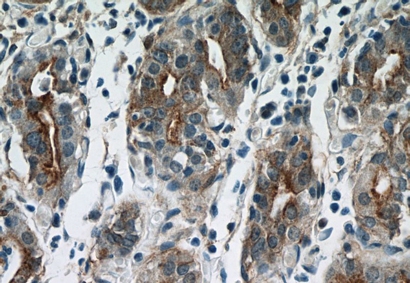 Immunohistochemistry of paraffin-embedded human stomach tissue slide using Catalog No:108095(Annexin IV Antibody) at dilution of 1:50 (under 40x lens)