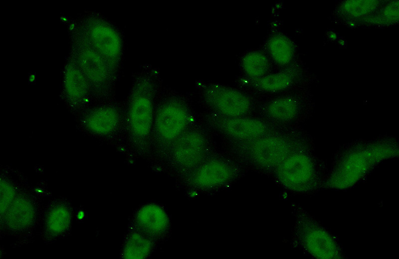 Immunofluorescent analysis of (10% Formaldehyde) fixed HeLa cells using Catalog No:115438(SMC3 Antibody) at dilution of 1:50 and Alexa Fluor 488-congugated AffiniPure Goat Anti-Rabbit IgG(H+L)