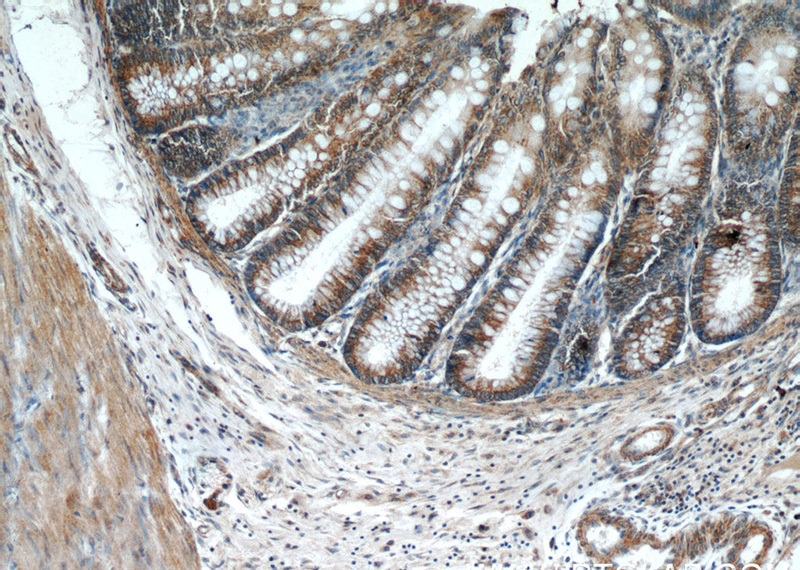 Immunohistochemistry of paraffin-embedded human colon tissue slide using Catalog No:113112(NELL1 Antibody) at dilution of 1:50 (under 10x lens)