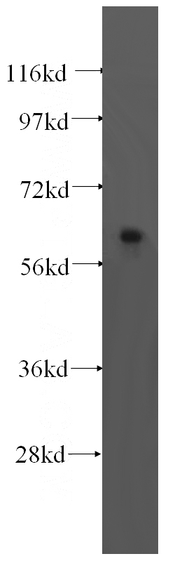 human brain tissue were subjected to SDS PAGE followed by western blot with Catalog No:116399(TRMT6 antibody) at dilution of 1:500
