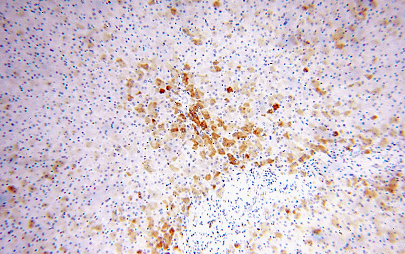 Immunohistochemical of paraffin-embedded human liver using Catalog No:115085(SEC61A1 antibody) at dilution of 1:100 (under 10x lens)