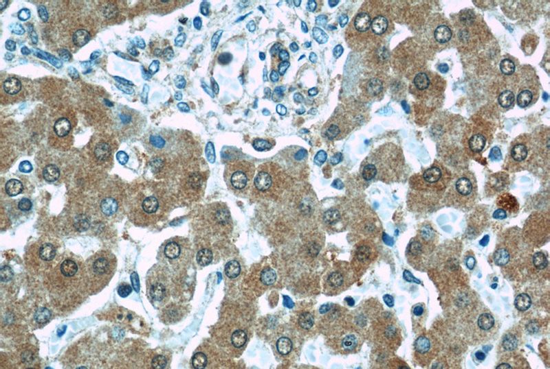 Immunohistochemical of paraffin-embedded human liver using Catalog No:114166(PRAP1 antibody) at dilution of 1:50 (under 40x lens)