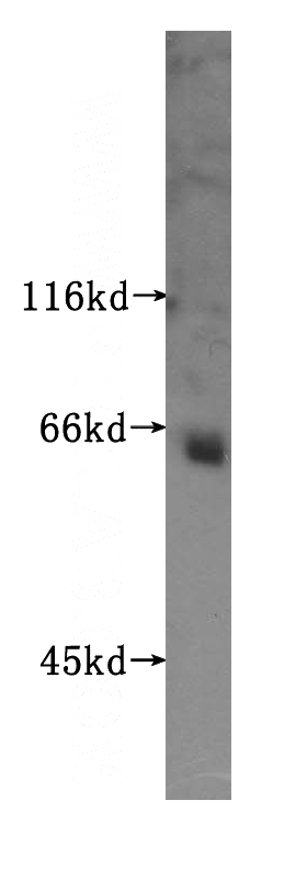 mouse pancreas tissue were subjected to SDS PAGE followed by western blot with Catalog No:113991(PODXL2 antibody) at dilution of 1:400