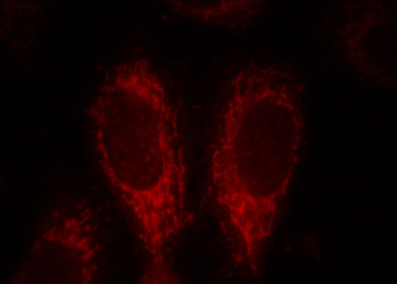 Immunofluorescent analysis of HepG2 cells, using ACSM3 antibody Catalog No:107700 at 1:25 dilution and Rhodamine-labeled goat anti-rabbit IgG (red).
