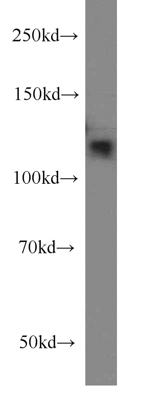 A2780 cells were subjected to SDS PAGE followed by western blot with Catalog No:112684(CASC3 antibody) at dilution of 1:300