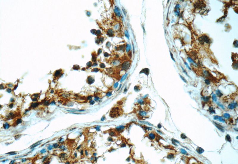 Immunohistochemistry of paraffin-embedded human testis tissue slide using Catalog No:113324(ODF1 Antibody) at dilution of 1:50 (under 40x lens)