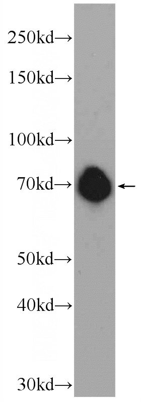 SH-SY5Y cells were subjected to SDS PAGE followed by western blot with Catalog No:110788(FUBP1 Antibody) at dilution of 1:1000