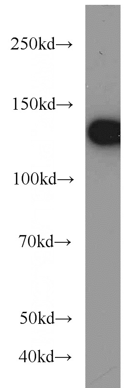Jurkat cells were subjected to SDS PAGE followed by western blot with Catalog No:109935(DHX9 antibody) at dilution of 1:1000