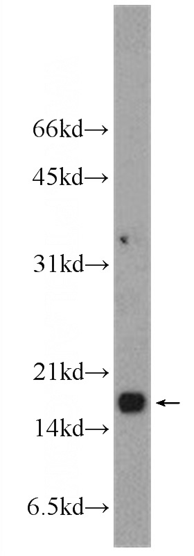 HepG2 cells were subjected to SDS PAGE followed by western blot with Catalog No:109855(DAD1 Antibody) at dilution of 1:1000