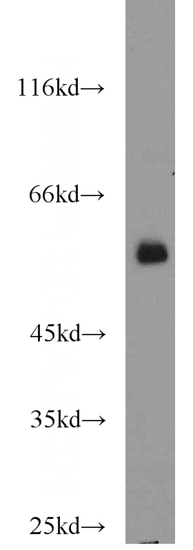 HeLa cells were subjected to SDS PAGE followed by western blot with Catalog No:110558(FBXO7 antibody) at dilution of 1:1000