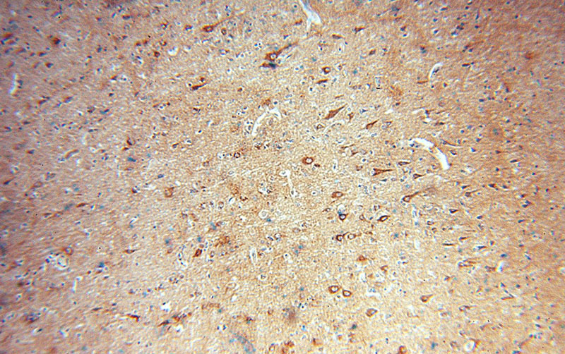 Immunohistochemical of paraffin-embedded human brain using Catalog No:114982(SCAMP1 antibody) at dilution of 1:100 (under 10x lens)