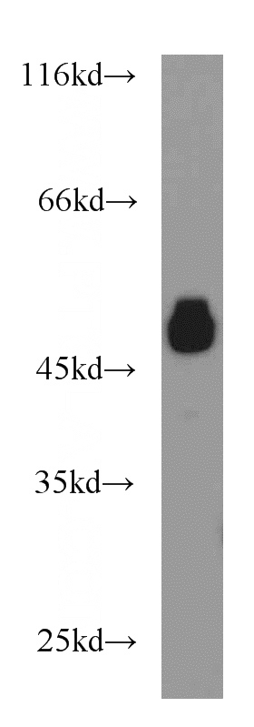 A375 cells were subjected to SDS PAGE followed by western blot with Catalog No:114864(RTN4 antibody) at dilution of 1:1000