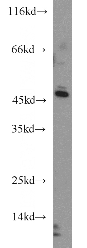 K-562 cells were subjected to SDS PAGE followed by western blot with Catalog No:116881(YARS2 antibody) at dilution of 1:800