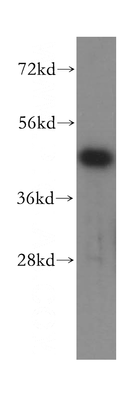 HeLa cells were subjected to SDS PAGE followed by western blot with Catalog No:112117(KPTN antibody) at dilution of 1:400