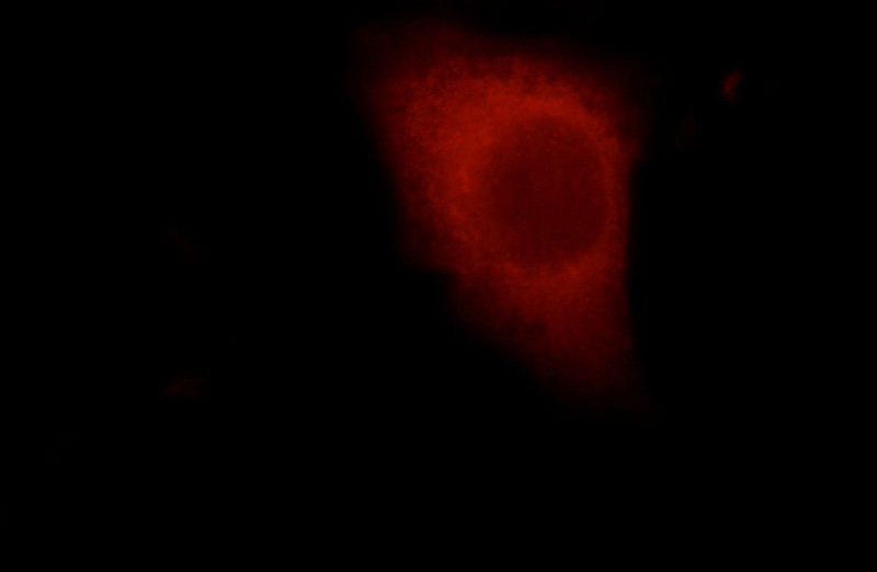 Immunofluorescent analysis of HepG2 cells, using ARHGEF12 antibody Catalog No:112144 at 1:50 dilution and Rhodamine-labeled goat anti-rabbit IgG (red).