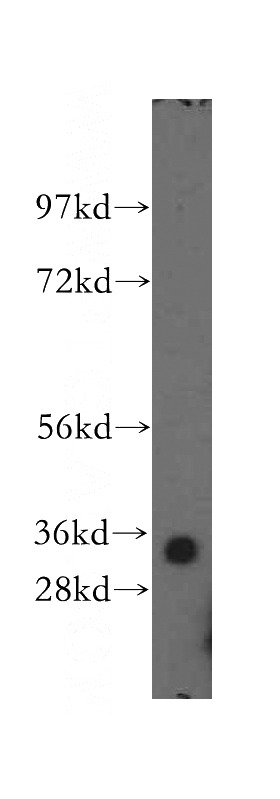 HEK-293 cells were subjected to SDS PAGE followed by western blot with Catalog No:111792(ING2 antibody) at dilution of 1:400