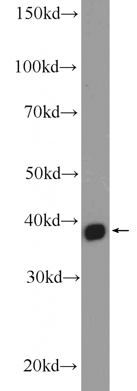 MCF-7 cells were subjected to SDS PAGE followed by western blot with Catalog No:112805(MRM1 Antibody) at dilution of 1:300
