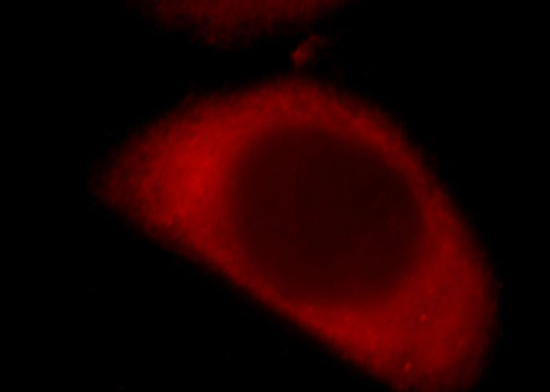 Immunofluorescent analysis of HepG2 cells, using SYNGAP1 antibody Catalog No:115783 at 1:25 dilution and Rhodamine-labeled goat anti-rabbit IgG (red).