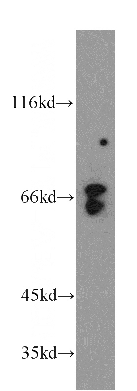 HeLa cells were subjected to SDS PAGE followed by western blot with Catalog No:108330(ATIC antibody) at dilution of 1:100