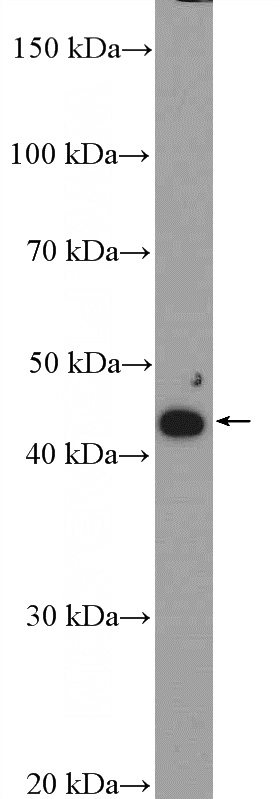 SMMC-7721 cells were subjected to SDS PAGE followed by western blot with Catalog No:116939(ZDHHC15 Antibody) at dilution of 1:1000