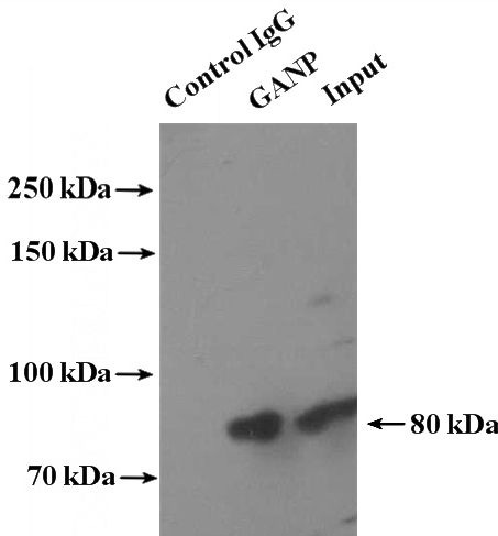 IP Result of anti-GANP (IP:Catalog No:110862, 4ug; Detection:Catalog No:110862 1:500) with mouse brain tissue lysate 4000ug.