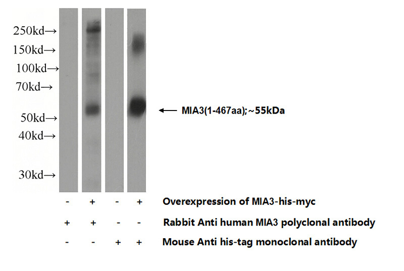 Transfected HEK-293 cells were subjected to SDS PAGE followed by western blot with Catalog No:112606(MIA3 Antibody) at dilution of 1:1000