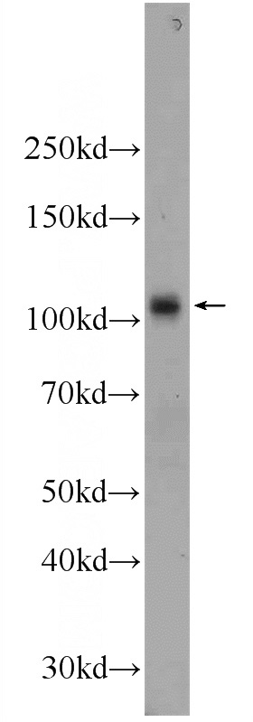 human blood tissue were subjected to SDS PAGE followed by western blot with Catalog No:108739(C6 Antibody) at dilution of 1:1000