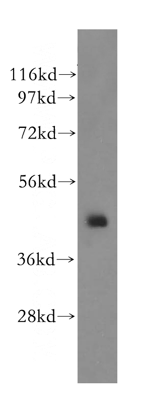 BxPC-3 cells were subjected to SDS PAGE followed by western blot with Catalog No:115020(SCRN2 antibody) at dilution of 1:400