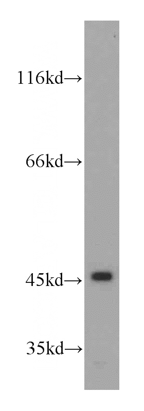 HeLa cells were subjected to SDS PAGE followed by western blot with Catalog No:113233(NR1I3 antibody) at dilution of 1:300