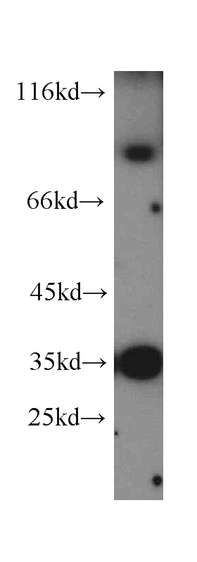 HT-1080 cells were subjected to SDS PAGE followed by western blot with Catalog No:112896(MUM1 antibody) at dilution of 1:300